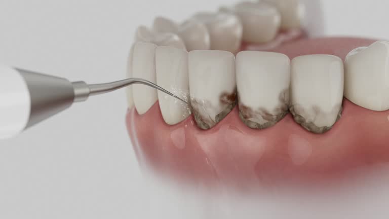 Trusted Root Canal Treatment service in Ferguson, MO - Dentist Open Now